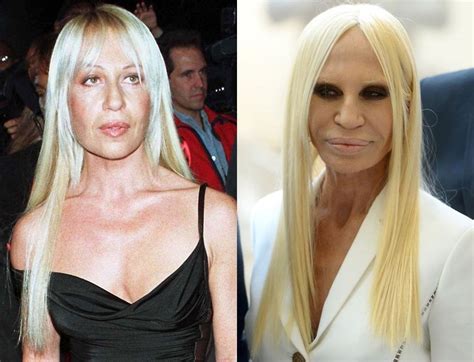 how to contact donatella versace|donatella versace before and after surgery.